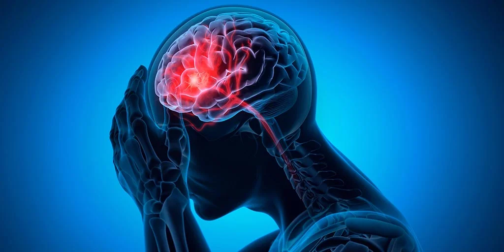 Early Signs of Stroke You Should Never Ignore